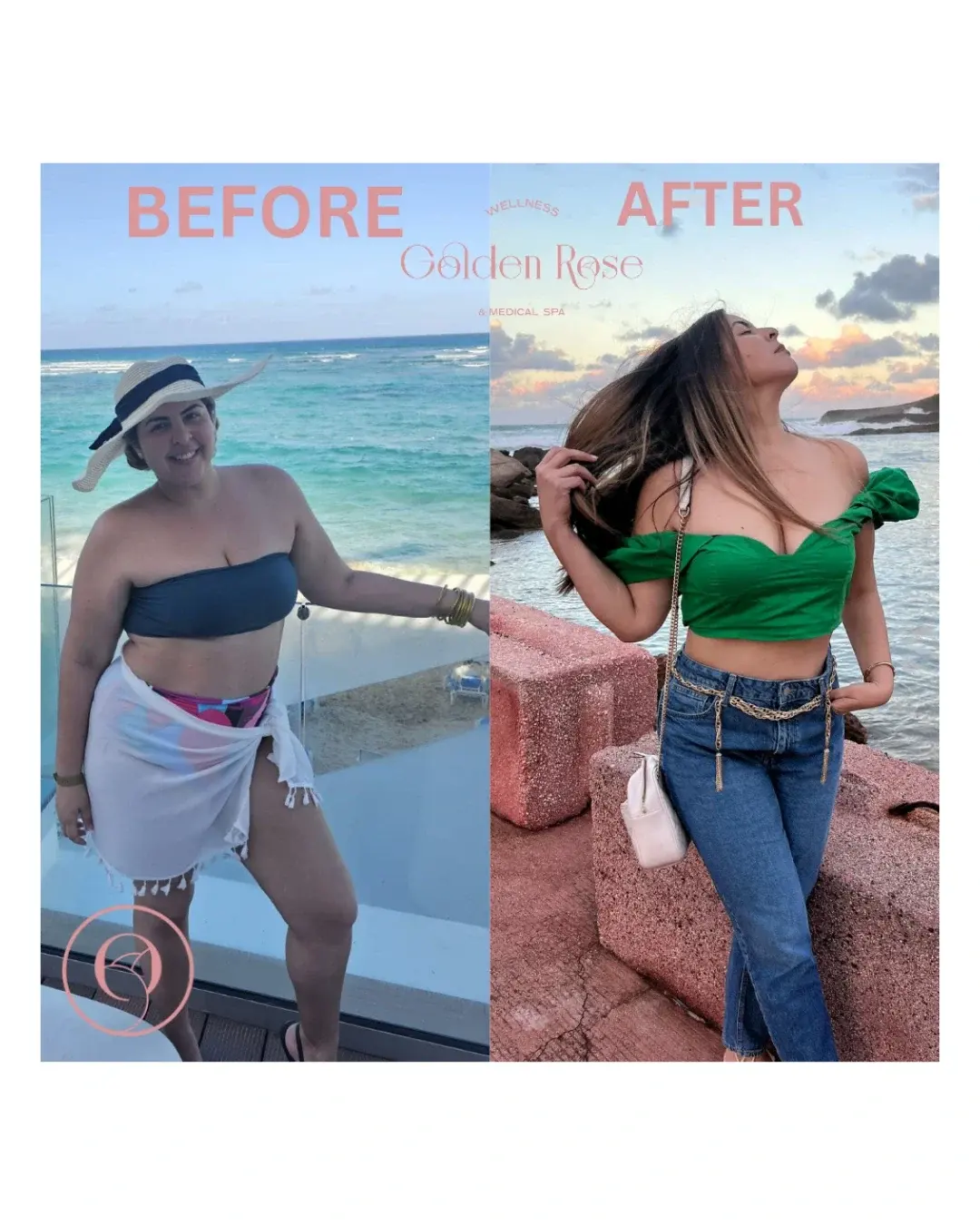 Pérdida de peso médica antes y después, cuerpo completo