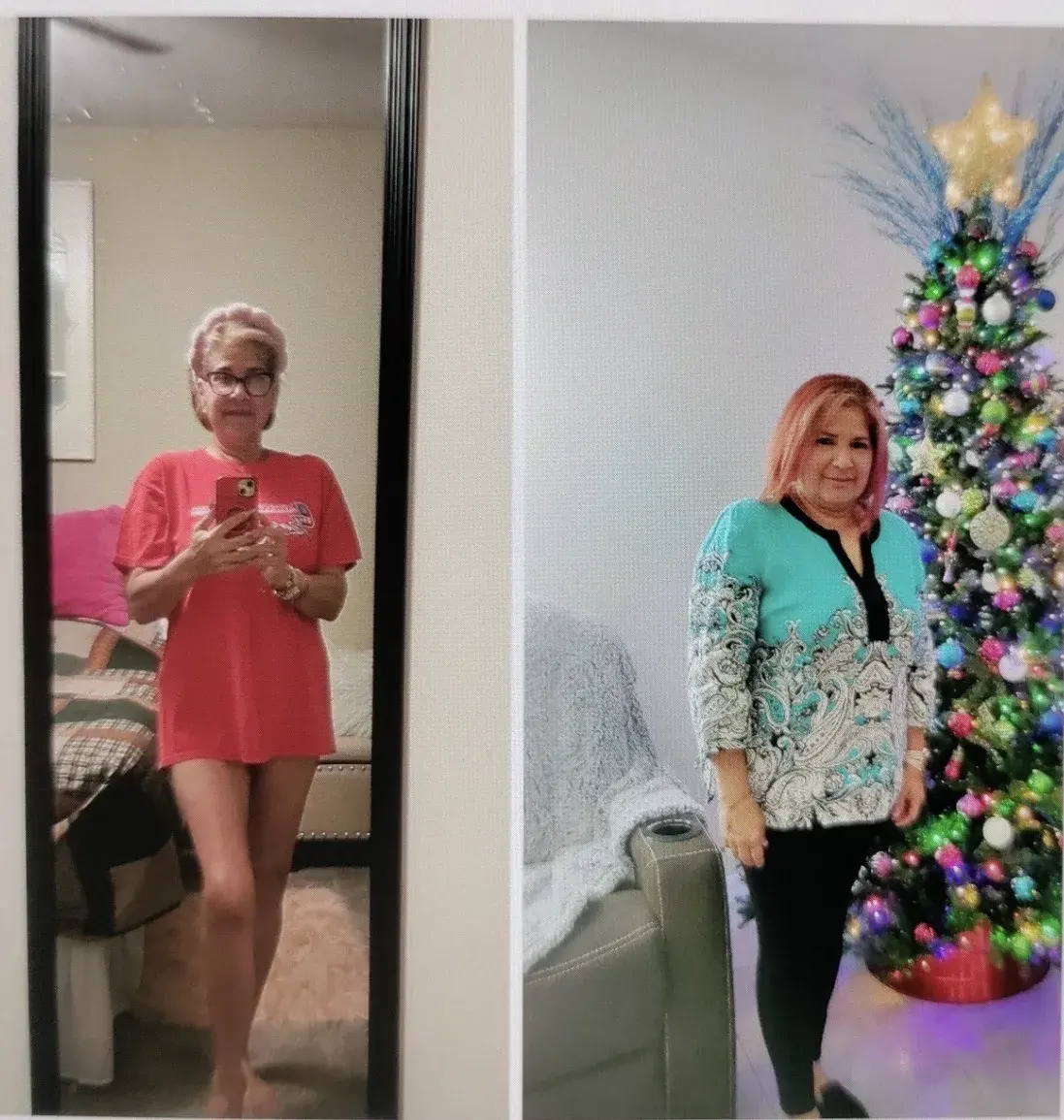 Pérdida de peso médica antes y después, cuerpo completo
