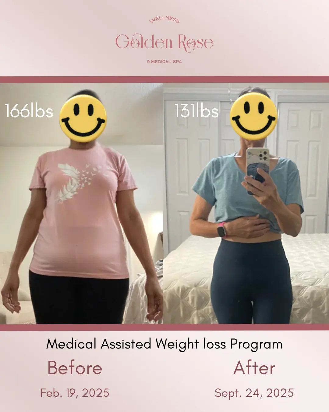 Pérdida de peso médica antes y después, cuerpo completo, rostros cubiertos