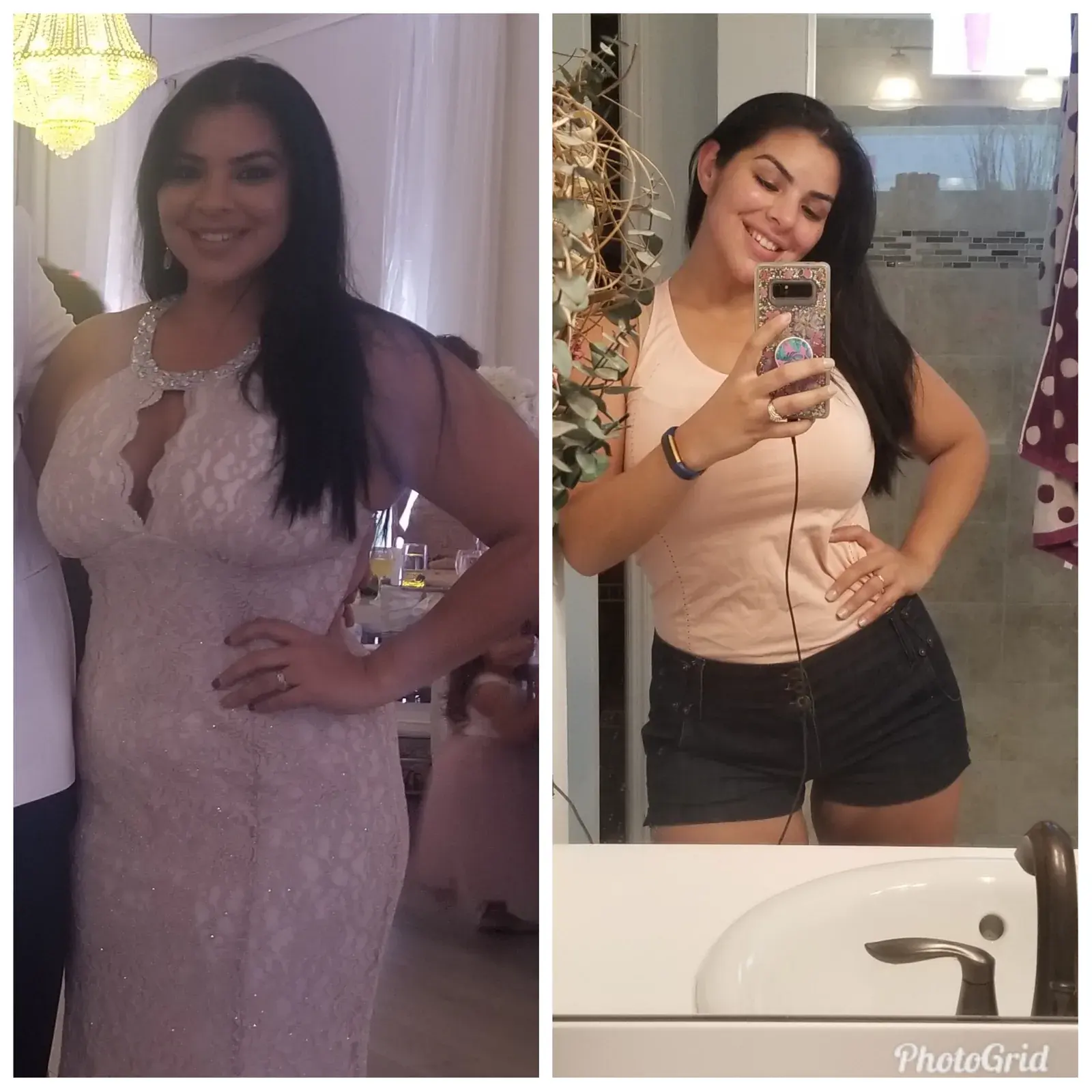Pérdida de peso médica antes y después, cuerpo completo
